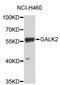 Galactokinase 2 antibody, STJ26500, St John