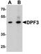 Zinc finger protein DPF3 antibody, TA326677, Origene, Western Blot image 