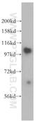 Adenosine Monophosphate Deaminase 2 antibody, 15710-1-AP, Proteintech Group, Western Blot image 