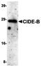 Cell Death Inducing DFFA Like Effector B antibody, orb74361, Biorbyt, Western Blot image 