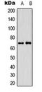 Glutathione S-transferase A2 antibody, orb341332, Biorbyt, Western Blot image 