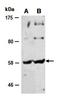 E3 ubiquitin-protein ligase Itchy homolog antibody, orb67190, Biorbyt, Western Blot image 