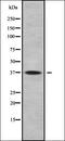 Dynein Light Chain Roadblock-Type 1 antibody, orb338267, Biorbyt, Western Blot image 