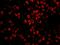 Serine/threonine-protein phosphatase 4 regulatory subunit 3A antibody, IHC-00469, Bethyl Labs, Immunofluorescence image 