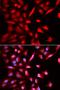 Mitogen-activated protein kinase-binding protein 1 antibody, orb154035, Biorbyt, Immunofluorescence image 