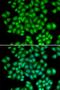 Fascin Actin-Bundling Protein 1 antibody, orb136337, Biorbyt, Immunocytochemistry image 
