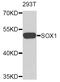SRY-Box 1 antibody, abx007253, Abbexa, Western Blot image 