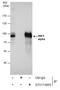 HNF1 Homeobox A antibody, GTX113850, GeneTex, Immunoprecipitation image 