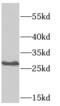 SSX Family Member 5 antibody, FNab08260, FineTest, Western Blot image 