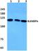 RAN Binding Protein 6 antibody, PA5-37033, Invitrogen Antibodies, Western Blot image 