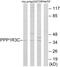 Protein Phosphatase 1 Regulatory Subunit 3C antibody, GTX87429, GeneTex, Western Blot image 