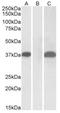 Pim-2 Proto-Oncogene, Serine/Threonine Kinase antibody, AP32927PU-N, Origene, Western Blot image 