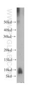 Platelet basic protein antibody, 13313-1-AP, Proteintech Group, Western Blot image 