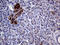 Polypeptide N-Acetylgalactosaminyltransferase 10 antibody, LS-C798687, Lifespan Biosciences, Immunohistochemistry paraffin image 