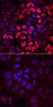 Homeobox protein Hox-B1 antibody, AF6318, R&D Systems, Immunofluorescence image 
