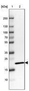 Chromosome 20 Open Reading Frame 27 antibody, PA5-61529, Invitrogen Antibodies, Western Blot image 