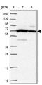 Sphingomyelin phosphodiesterase 4 antibody, NBP2-33567, Novus Biologicals, Western Blot image 