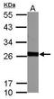 Glutathione S-transferase Mu 5 antibody, GTX108776, GeneTex, Western Blot image 