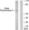 DNA polymerase lambda antibody, TA312738, Origene, Western Blot image 