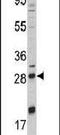Nerve Growth Factor antibody, PA5-14872, Invitrogen Antibodies, Western Blot image 