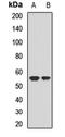 Eukaryotic translation initiation factor 5 antibody, LS-C667797, Lifespan Biosciences, Western Blot image 