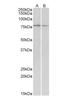 Dystroglycan 1 antibody, NBP1-52049, Novus Biologicals, Western Blot image 