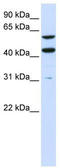 Phosphatidylserine Synthase 1 antibody, TA341954, Origene, Western Blot image 