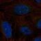 ERCC Excision Repair 6, Chromatin Remodeling Factor antibody, HPA071297, Atlas Antibodies, Immunofluorescence image 