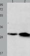Oxidized Low Density Lipoprotein Receptor 1 antibody, TA321497, Origene, Western Blot image 