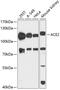 Angiotensin I Converting Enzyme 2 antibody, 24-030, ProSci, Western Blot image 
