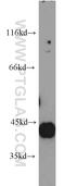 Hyaluronan And Proteoglycan Link Protein 4 antibody, 21228-1-AP, Proteintech Group, Western Blot image 