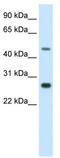 Spermatogenic leucine zipper protein 1 antibody, TA329956, Origene, Western Blot image 