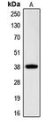 Cell Growth Regulator With Ring Finger Domain 1 antibody, MBS820935, MyBioSource, Western Blot image 