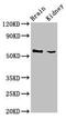 Calcium-binding mitochondrial carrier protein SCaMC-3 antibody, orb53819, Biorbyt, Western Blot image 