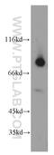 Calpain 2 antibody, 11472-1-AP, Proteintech Group, Western Blot image 
