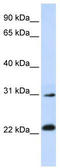 AP-3 complex subunit sigma-1 antibody, TA340005, Origene, Western Blot image 