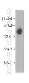 NADH-ubiquinone oxidoreductase 75 kDa subunit, mitochondrial antibody, 12444-1-AP, Proteintech Group, Western Blot image 