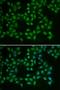 Bruton Tyrosine Kinase antibody, LS-C331556, Lifespan Biosciences, Immunofluorescence image 