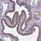 Leucine-rich repeat LGI family member 4 antibody, NBP2-30423, Novus Biologicals, Immunohistochemistry paraffin image 