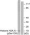 H2A Histone Family Member X antibody, LS-C117373, Lifespan Biosciences, Western Blot image 