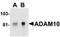 ADAM Metallopeptidase Domain 10 antibody, AP05830PU-N, Origene, Western Blot image 