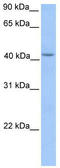 Hydroxymethylbilane Synthase antibody, TA334952, Origene, Western Blot image 