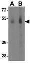 Fasciculation And Elongation Protein Zeta 1 antibody, GTX16992, GeneTex, Western Blot image 