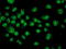 Activating Signal Cointegrator 1 Complex Subunit 1 antibody, TA503720, Origene, Immunofluorescence image 