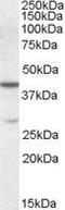 Chromobox 8 antibody, GTX88655, GeneTex, Western Blot image 