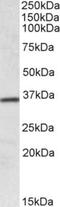 Homeobox protein Hox-A4 antibody, NBP1-52039, Novus Biologicals, Western Blot image 