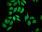 LIM And Cysteine Rich Domains 1 antibody, LS-C673773, Lifespan Biosciences, Immunofluorescence image 
