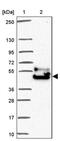 Family With Sequence Similarity 149 Member A antibody, PA5-63048, Invitrogen Antibodies, Western Blot image 