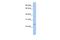 PRELI Domain Containing 2 antibody, A16775, Boster Biological Technology, Western Blot image 