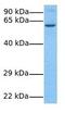 TBC1 domain family member 24 antibody, GTX44910, GeneTex, Western Blot image 